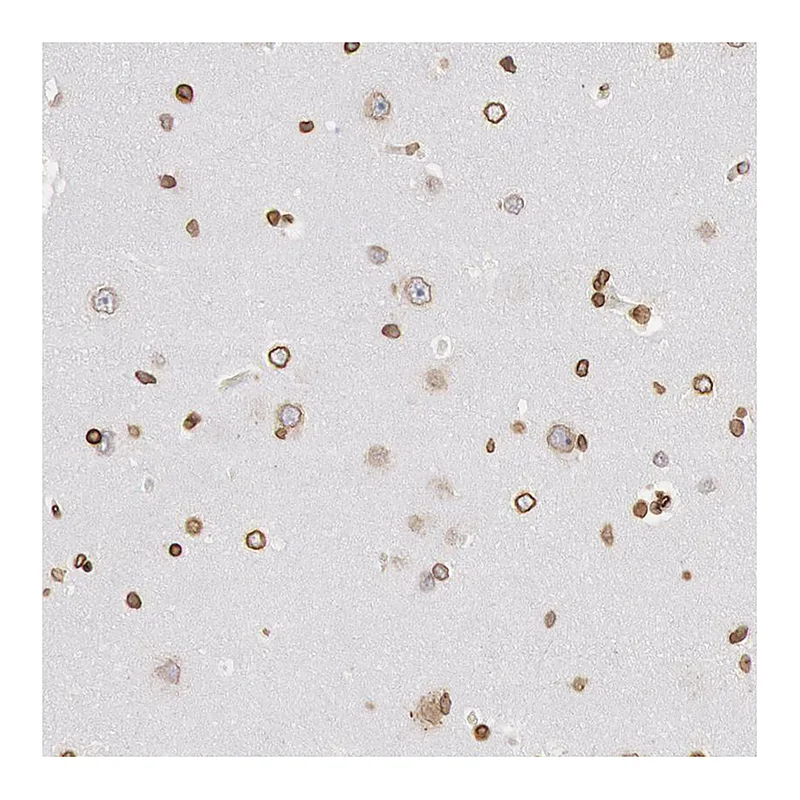 Atlas Antibodies Anti-SUN2 Antibody