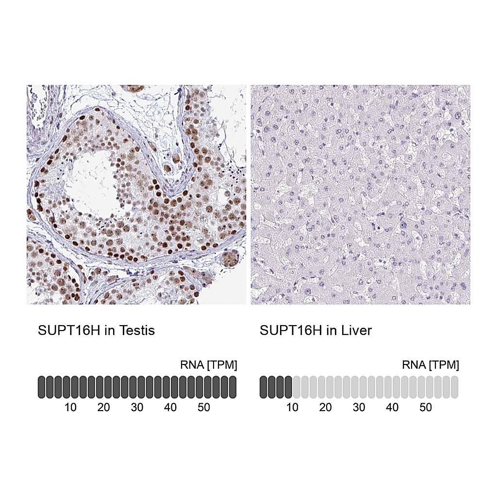 Atlas Antibodies Anti-SUPT16H Antibody