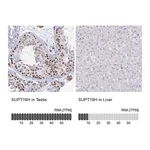 Atlas Antibodies Anti-SUPT16H Antibody