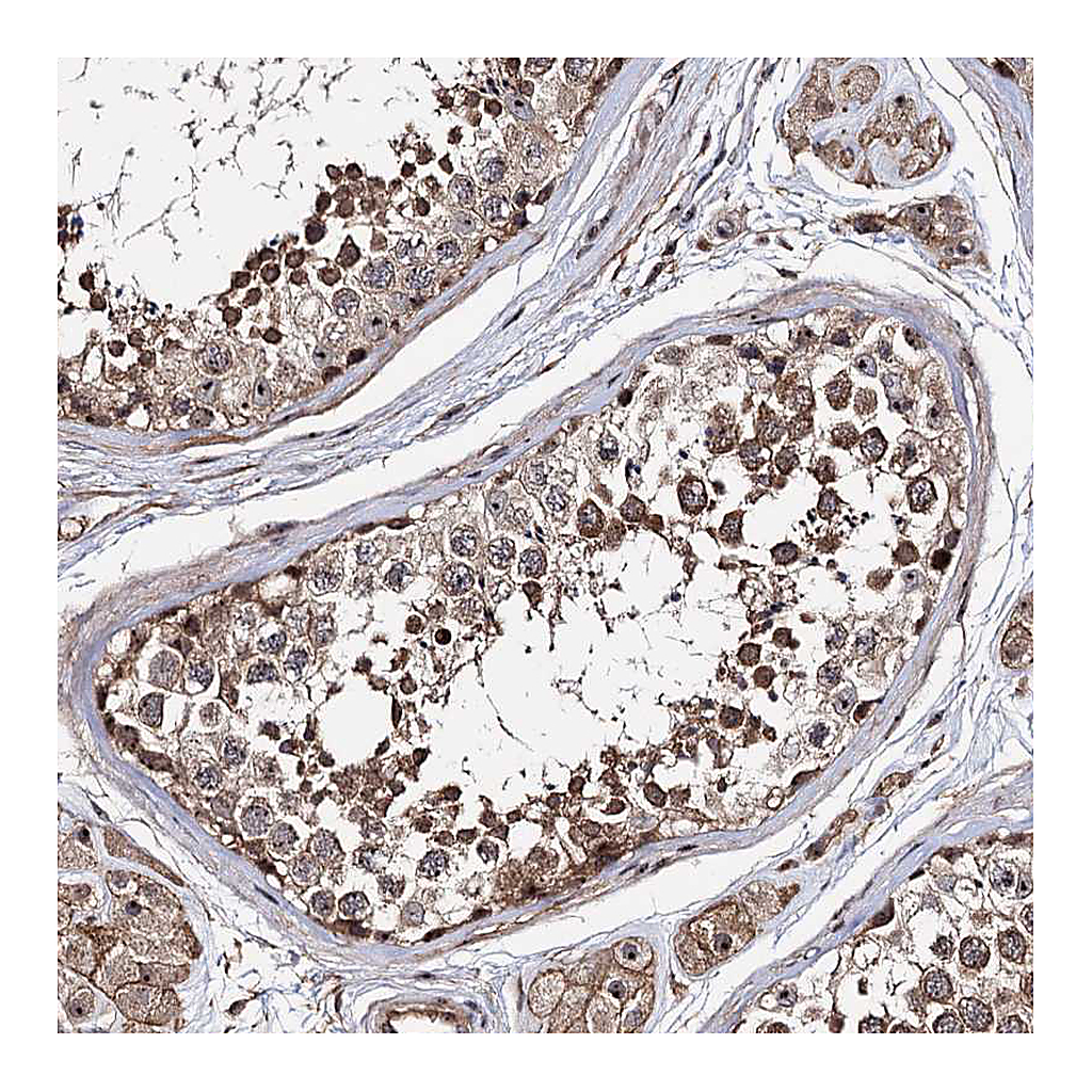 Atlas Antibodies Anti-SUPT20H Antibody