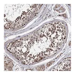 Atlas Antibodies Anti-SUPT20H Antibody