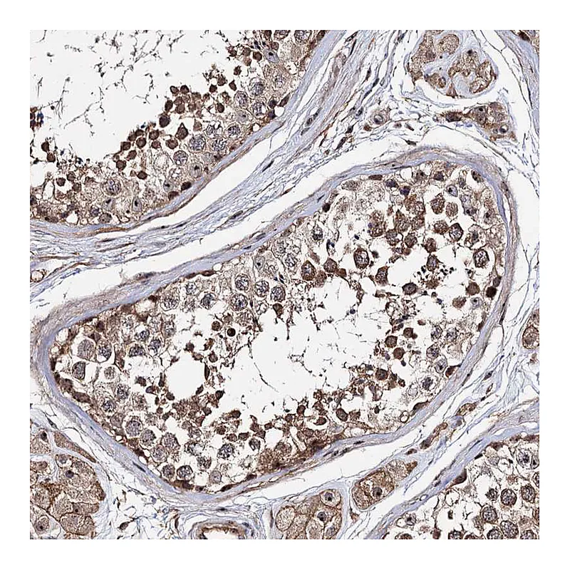 Atlas Antibodies Anti-SUPT20H Antibody