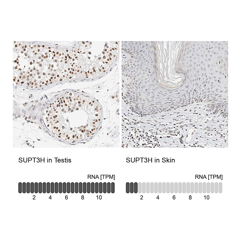Atlas Antibodies Anti-SUPT3H Antibody