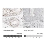 Atlas Antibodies Anti-SUPT3H Antibody