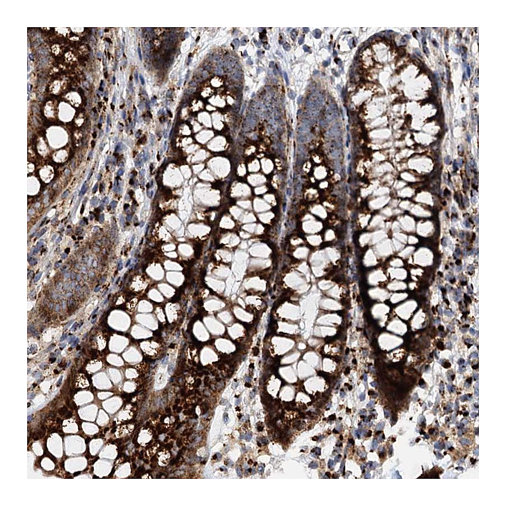 Atlas Antibodies Anti-SUPT20H Antibody