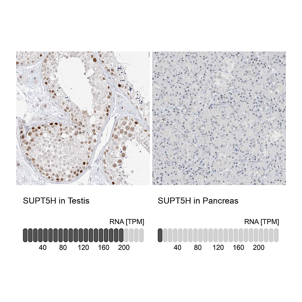 Atlas Antibodies Anti-SUPT5H Antibody