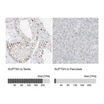 Atlas Antibodies Anti-SUPT5H Antibody