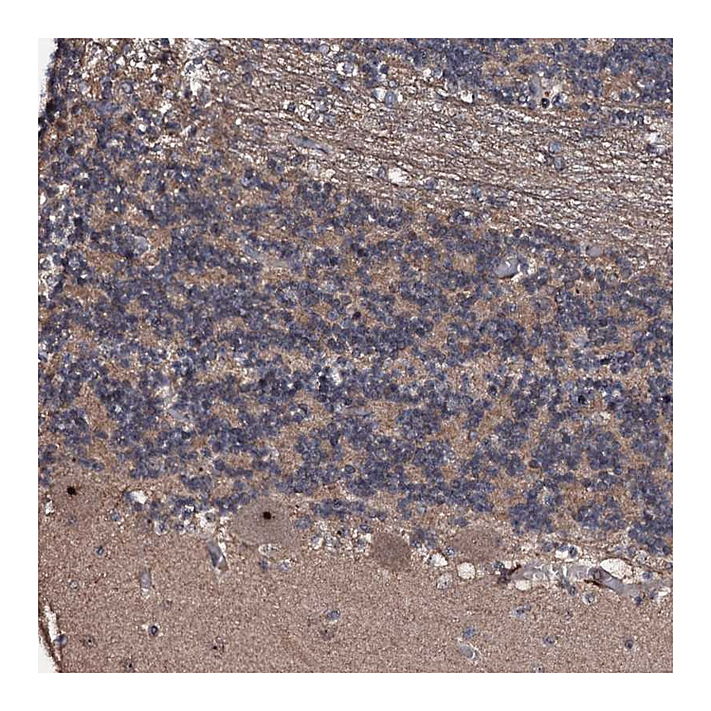 Atlas Antibodies Anti-SUPT7L Antibody