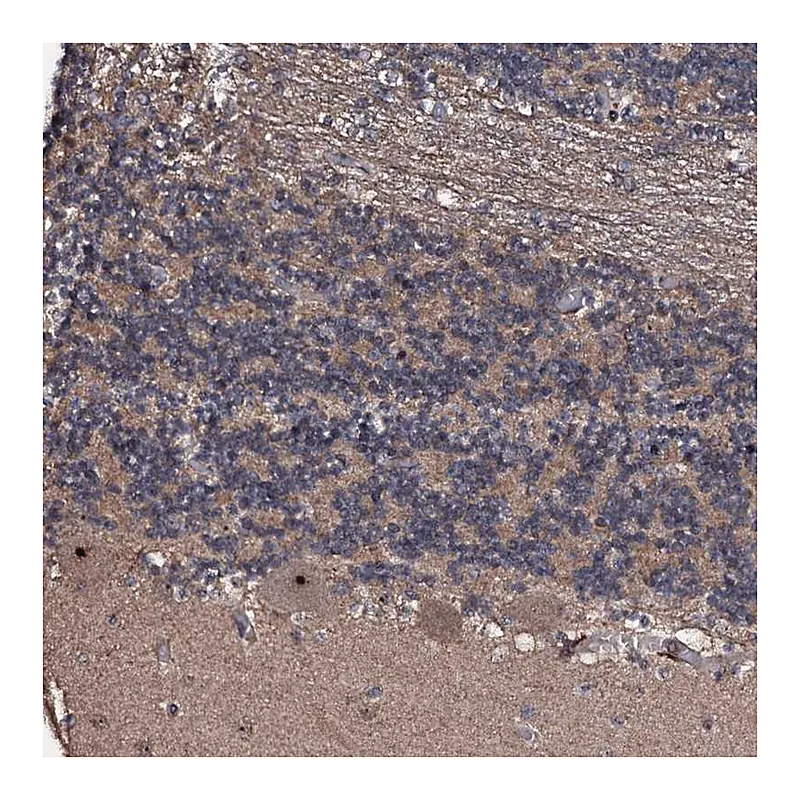 Atlas Antibodies Anti-SUPT7L Antibody