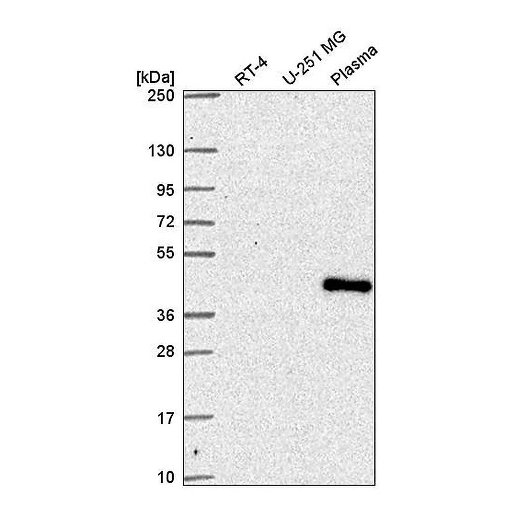 Atlas Antibodies Anti-SUPT7L Antibody