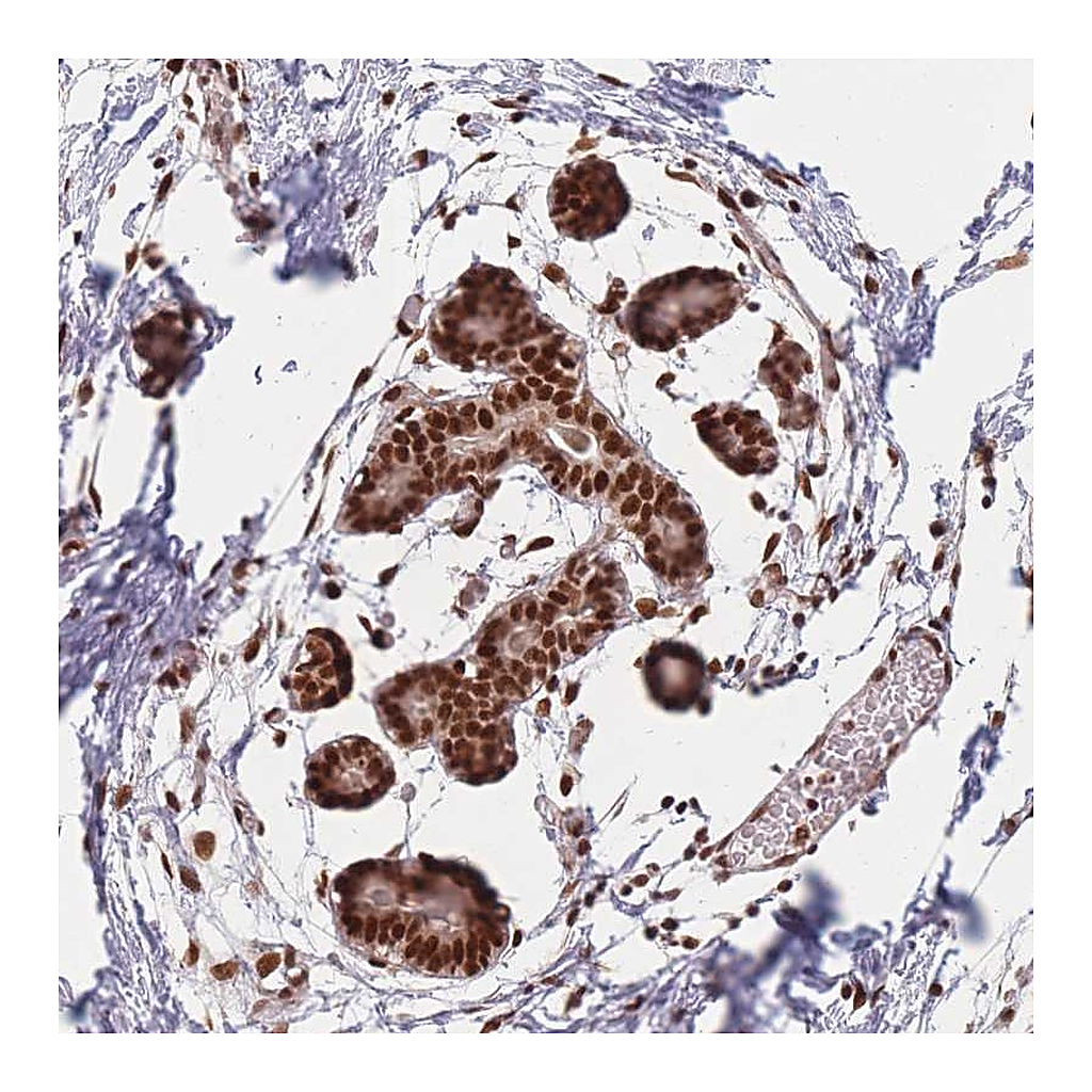 Atlas Antibodies Anti-SUPT6H Antibody