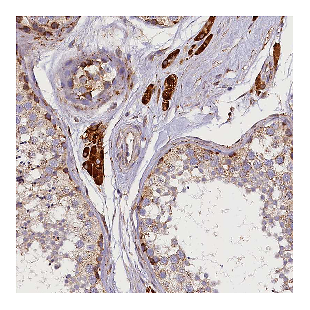 Atlas Antibodies Anti-SUPV3L1 Antibody