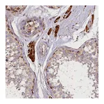 Atlas Antibodies Anti-SUPV3L1 Antibody