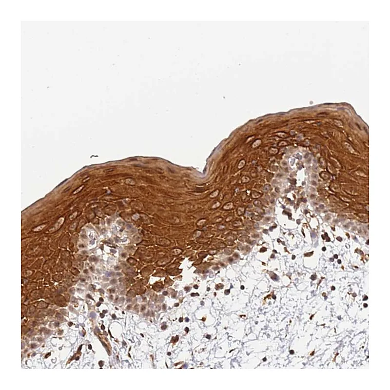 Atlas Antibodies Anti-SURF2 Antibody