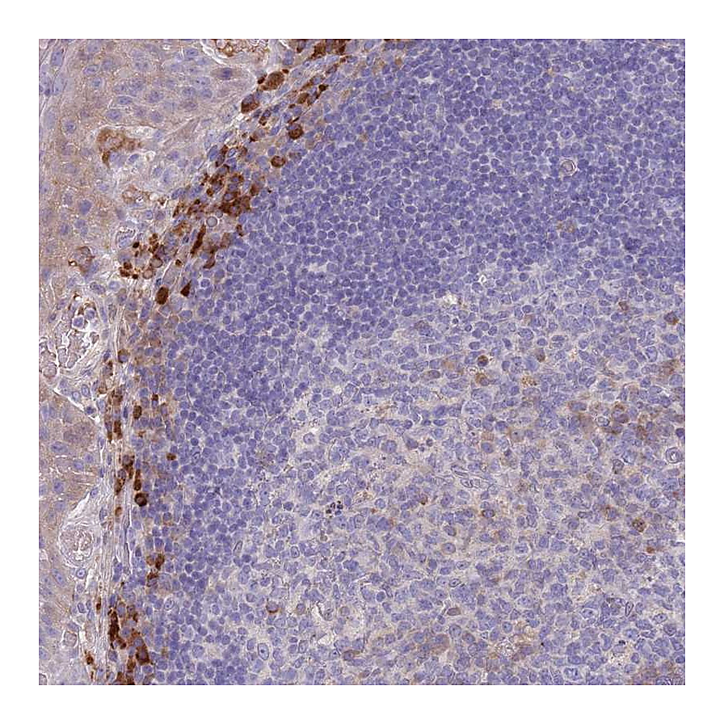 Atlas Antibodies Anti-SUSD1 Antibody