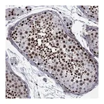 Atlas Antibodies Anti-SURF2 Antibody