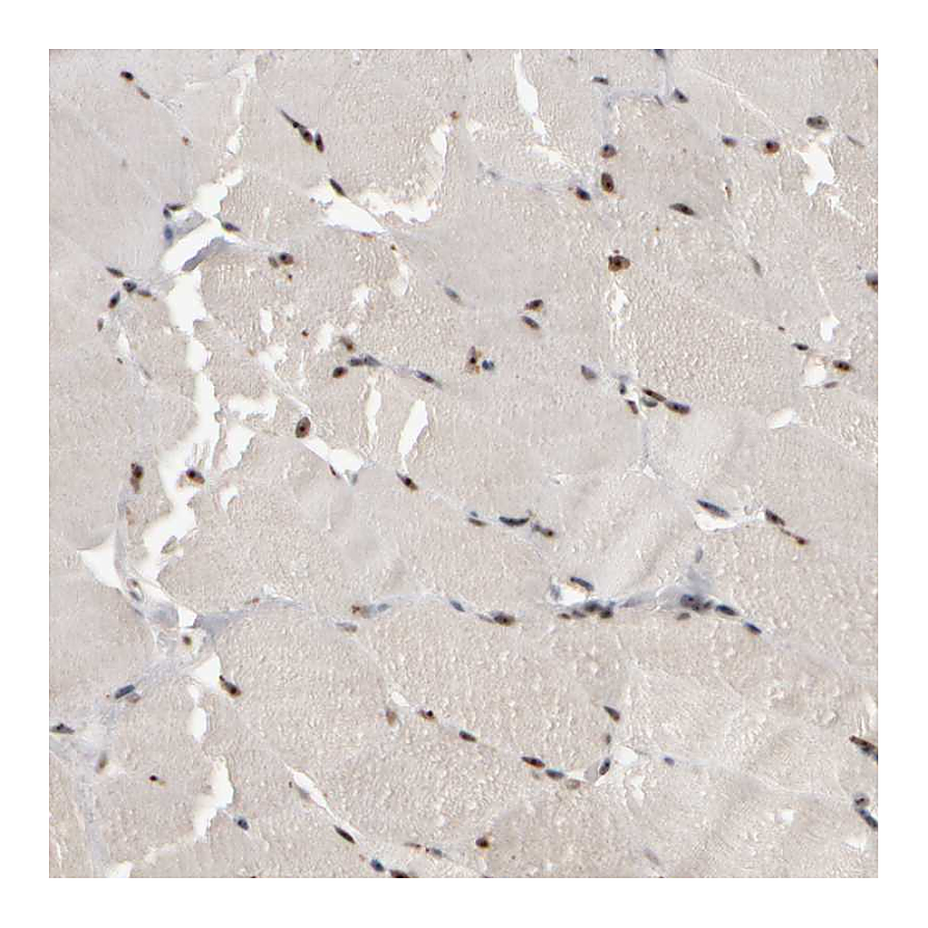 Atlas Antibodies Anti-SURF6 Antibody