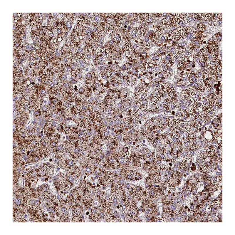 Atlas Antibodies Anti-SUSD3 Antibody