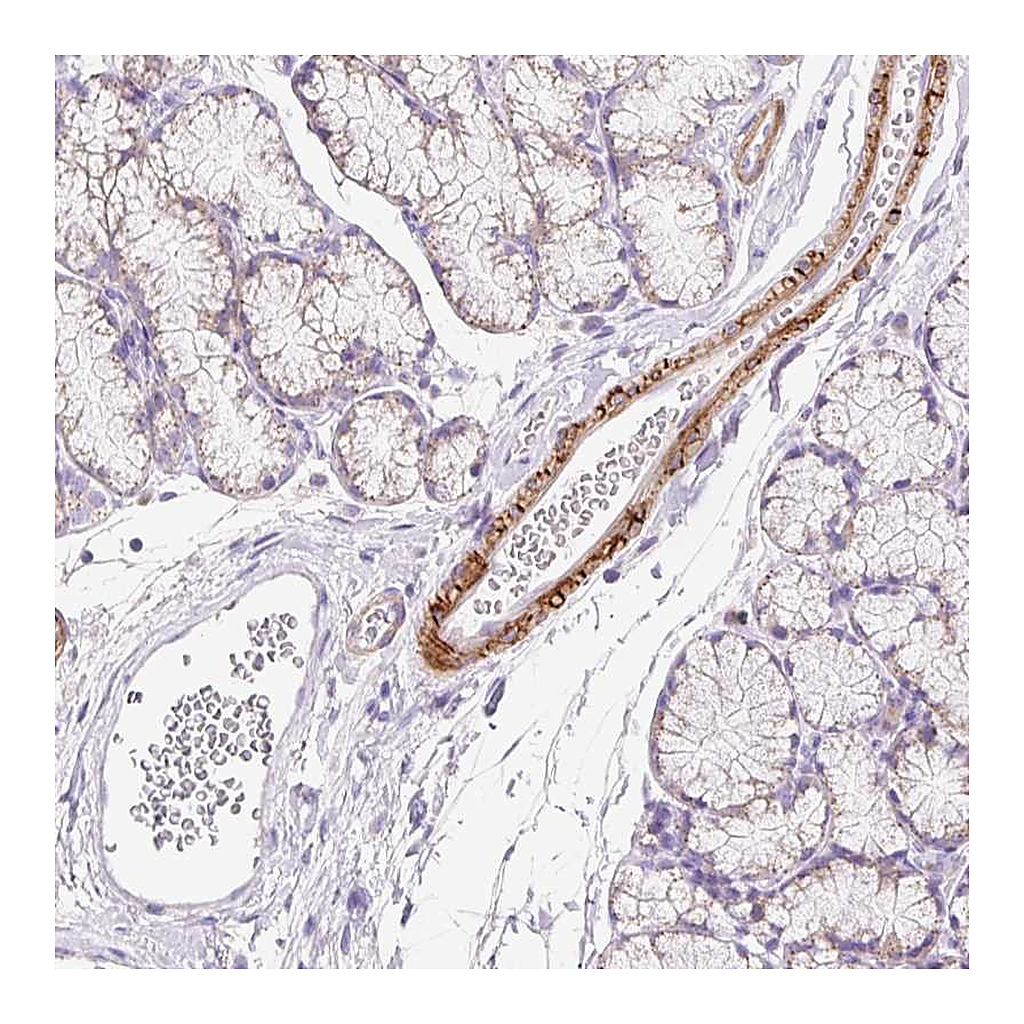 Atlas Antibodies Anti-SUSD5 Antibody