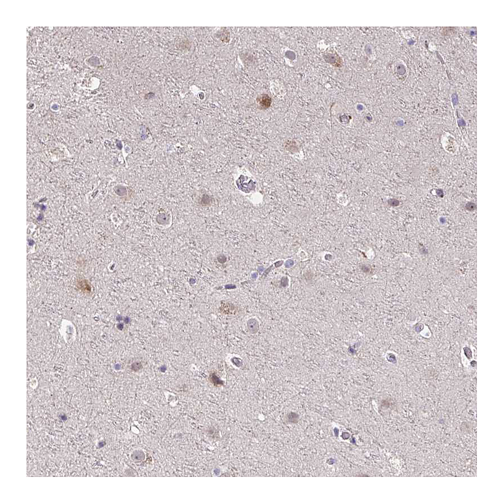 Atlas Antibodies Anti-SUSD4 Antibody