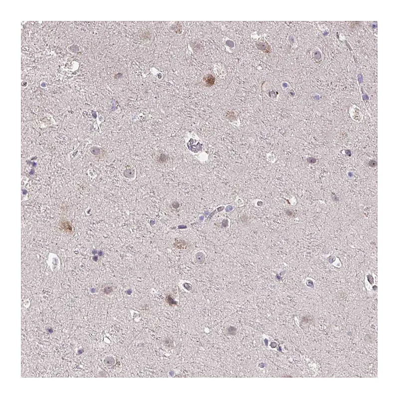 Atlas Antibodies Anti-SUSD4 Antibody