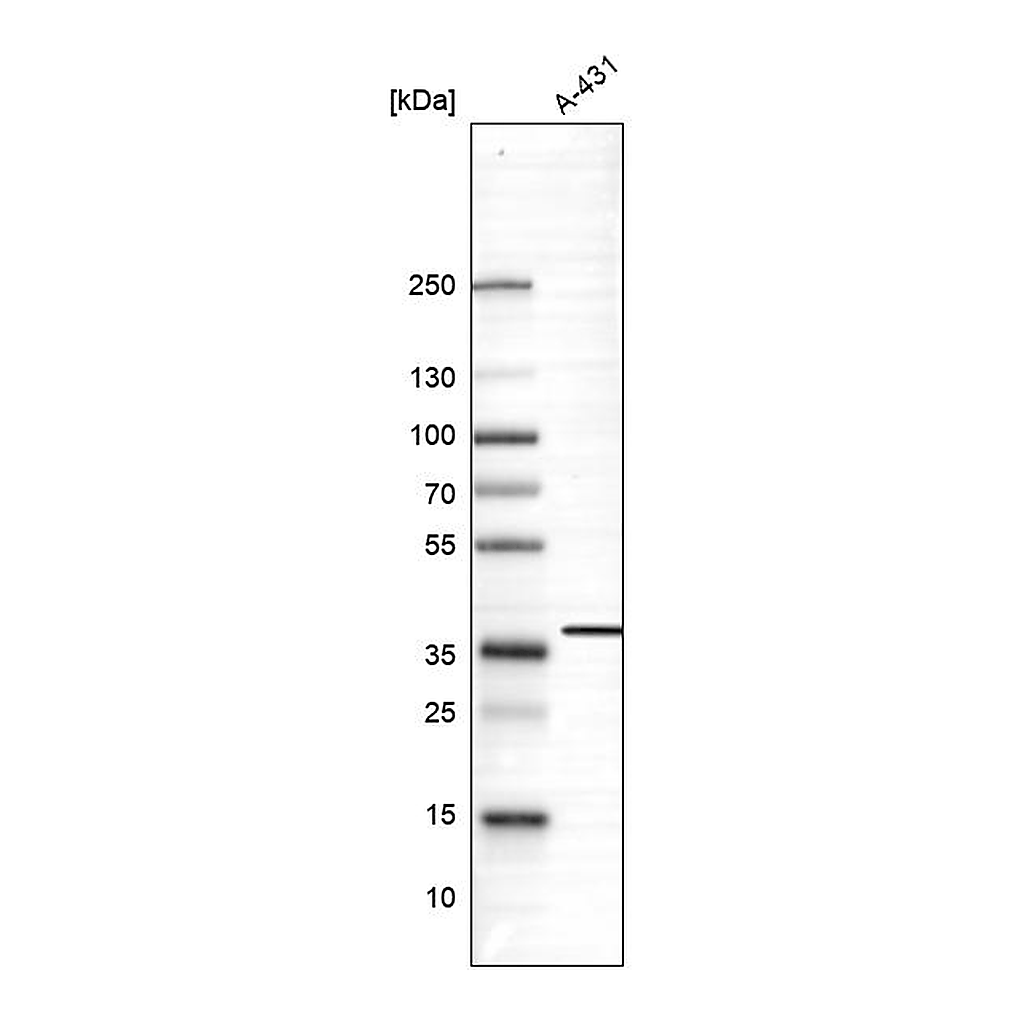 Atlas Antibodies Anti-SUSD6 Antibody