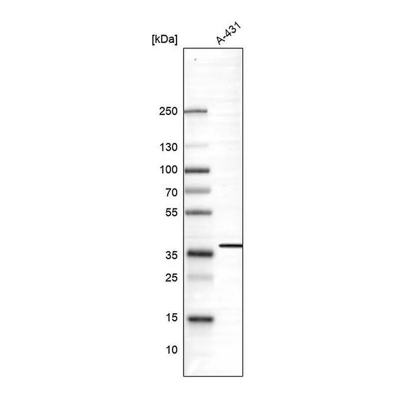 Atlas Antibodies Anti-SUSD6 Antibody