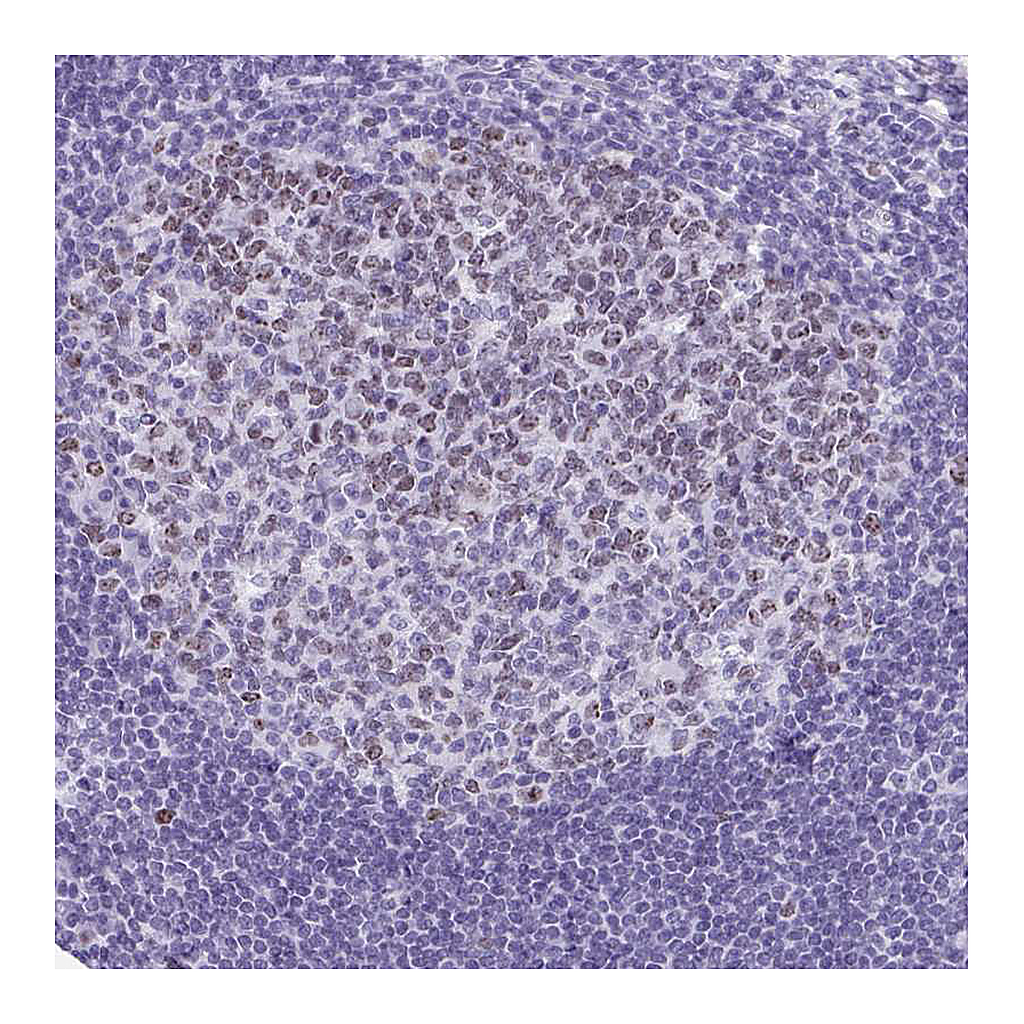 Atlas Antibodies Anti-SUZ12 Antibody