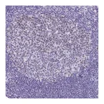 Atlas Antibodies Anti-SUZ12 Antibody