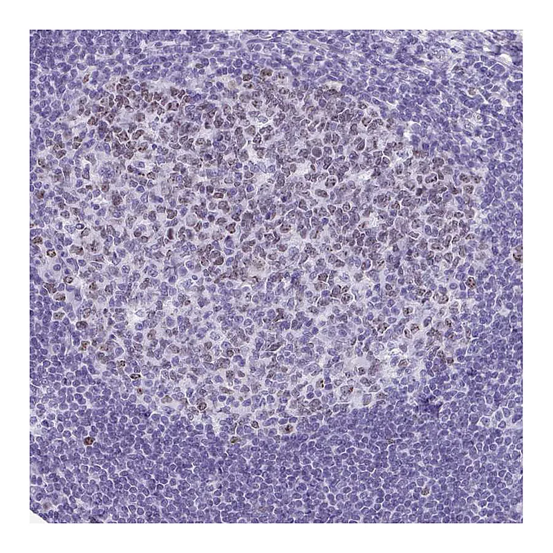 Atlas Antibodies Anti-SUZ12 Antibody