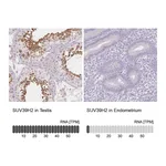Atlas Antibodies Anti-SUV39H2 Antibody
