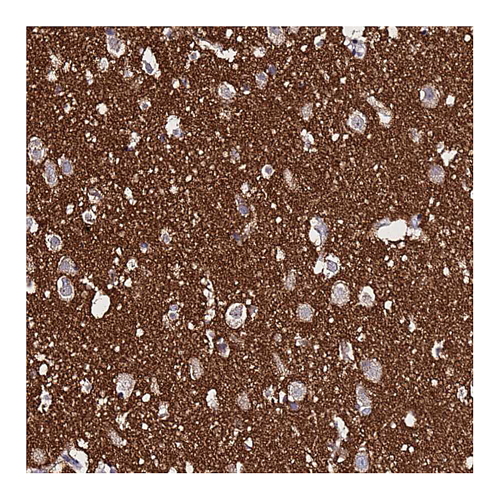 Atlas Antibodies Anti-SV2B Antibody