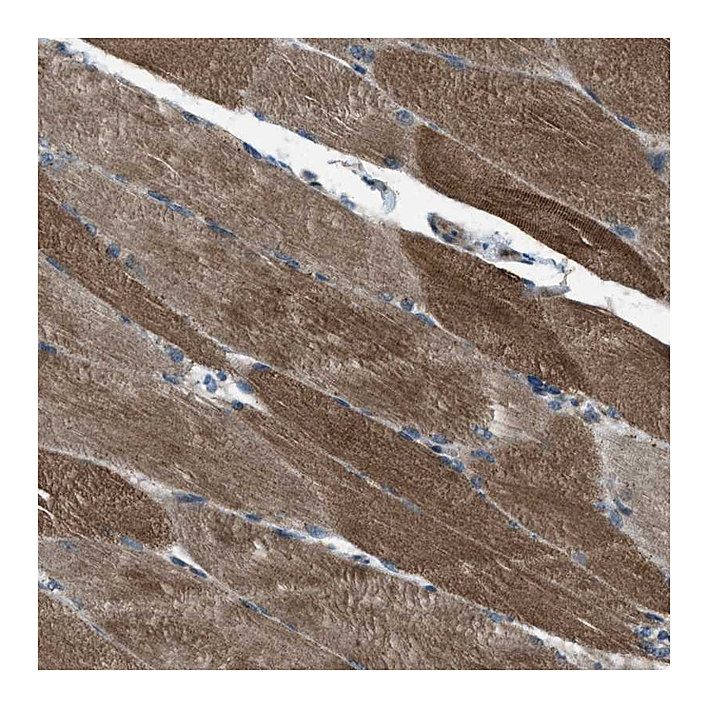 Atlas Antibodies Anti-SVIL Antibody