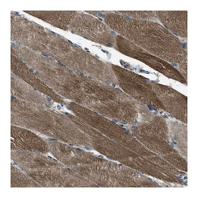 Atlas Antibodies Anti-SVIL Antibody