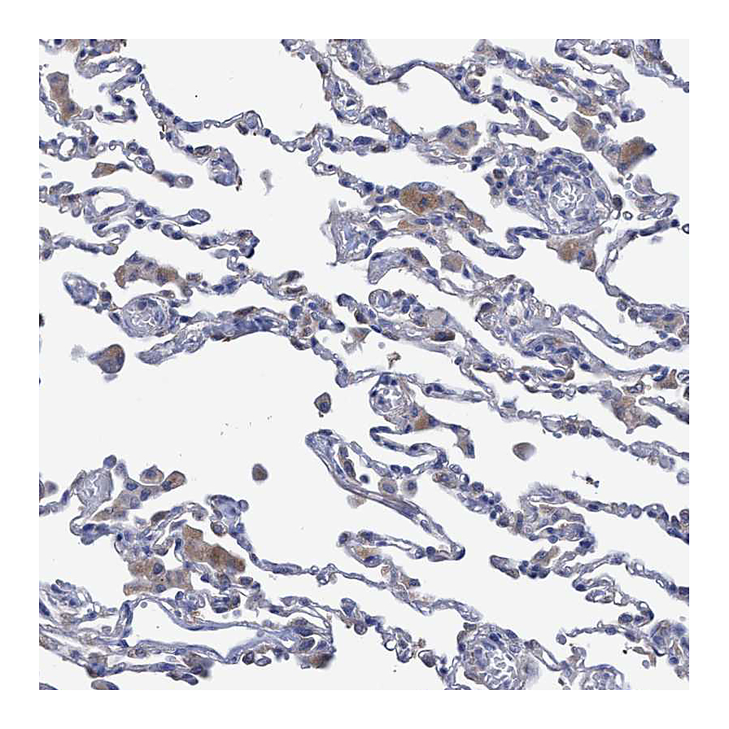 Atlas Antibodies Anti-SVEP1 Antibody