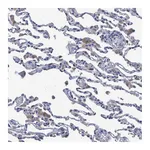 Atlas Antibodies Anti-SVEP1 Antibody