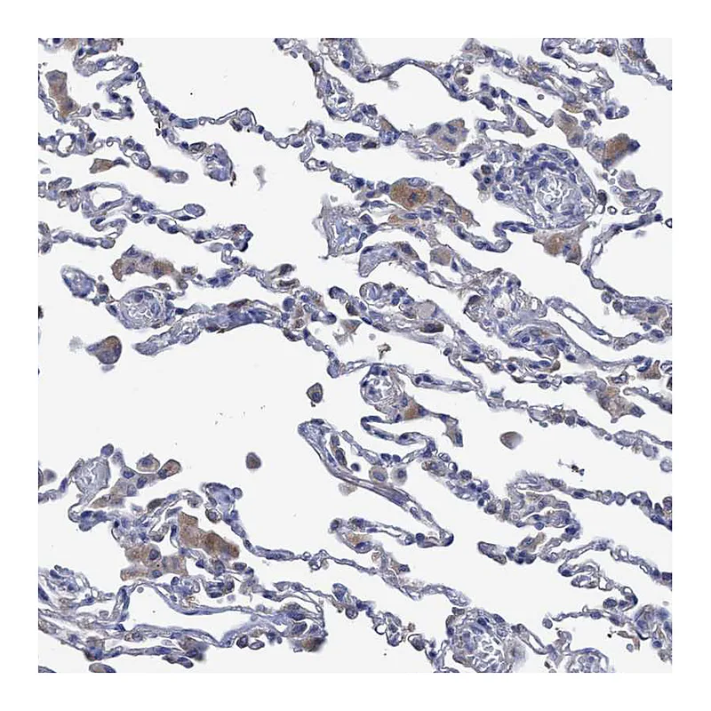 Atlas Antibodies Anti-SVEP1 Antibody