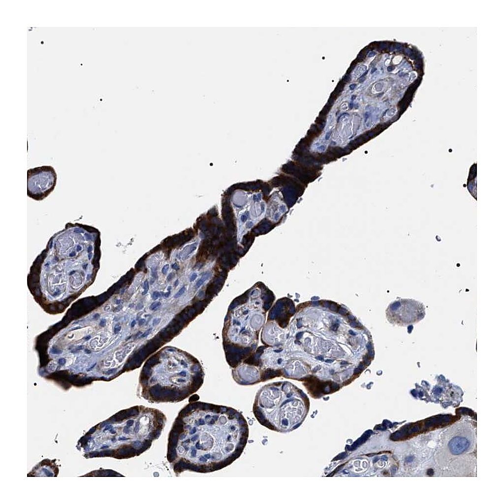 Atlas Antibodies Anti-SVEP1 Antibody