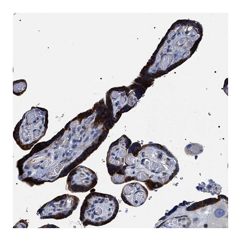 Atlas Antibodies Anti-SVEP1 Antibody