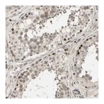 Atlas Antibodies Anti-SVBP Antibody