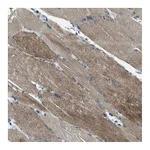 Atlas Antibodies Anti-SVIL Antibody