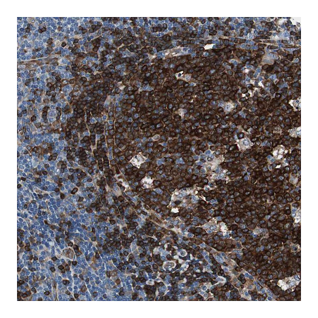Atlas Antibodies Anti-SWAP70 Antibody