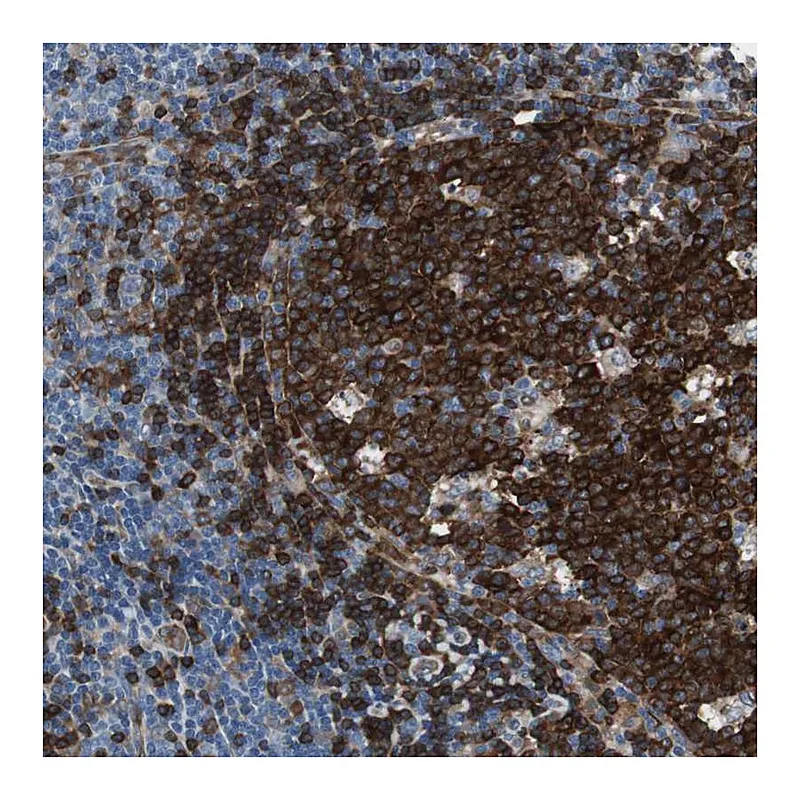 Atlas Antibodies Anti-SWAP70 Antibody