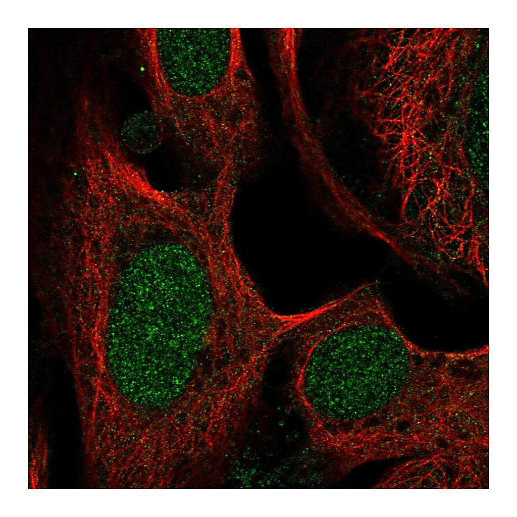 Atlas Antibodies Anti-SWI5 Antibody