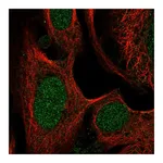 Atlas Antibodies Anti-SWI5 Antibody