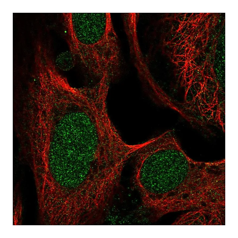 Atlas Antibodies Anti-SWI5 Antibody
