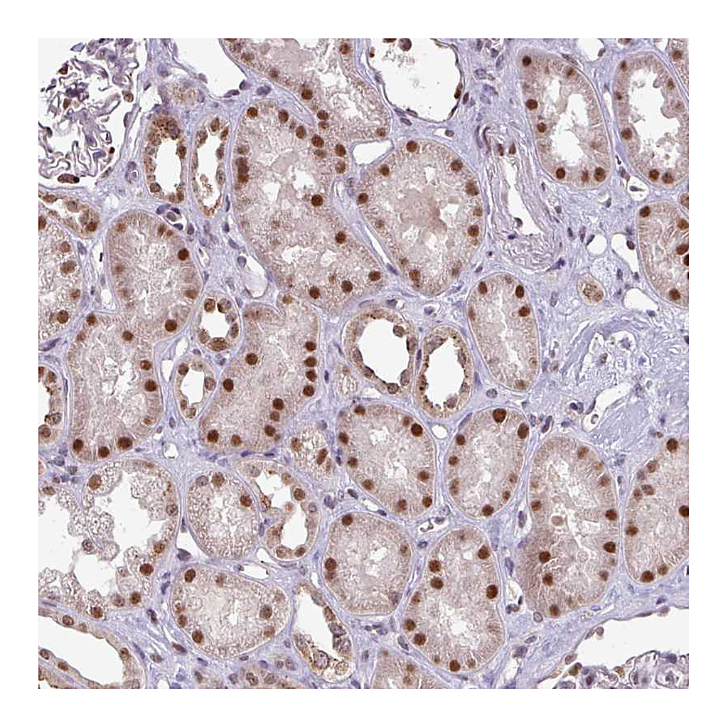 Atlas Antibodies Anti-SWSAP1 Antibody