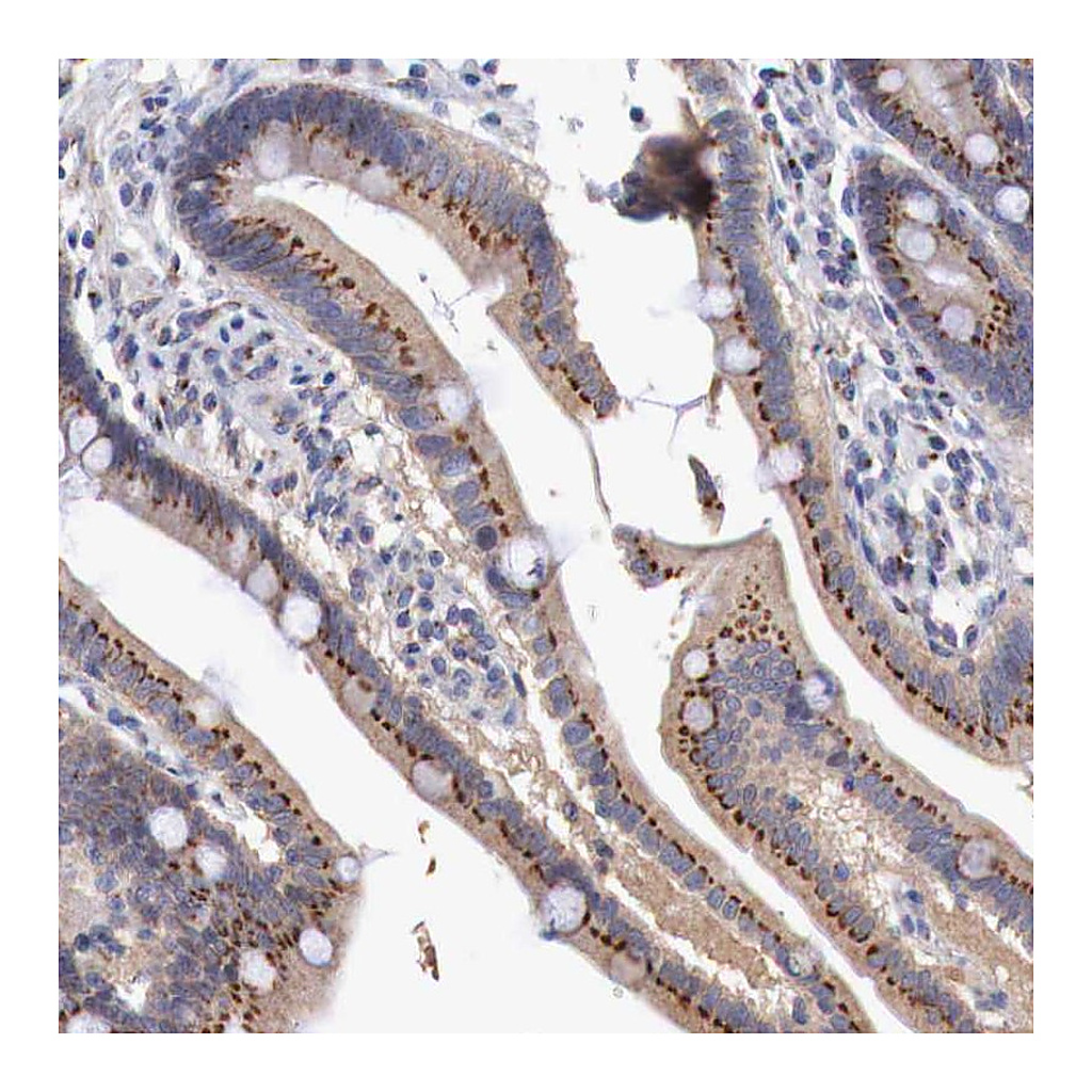 Atlas Antibodies Anti-SYAP1 Antibody