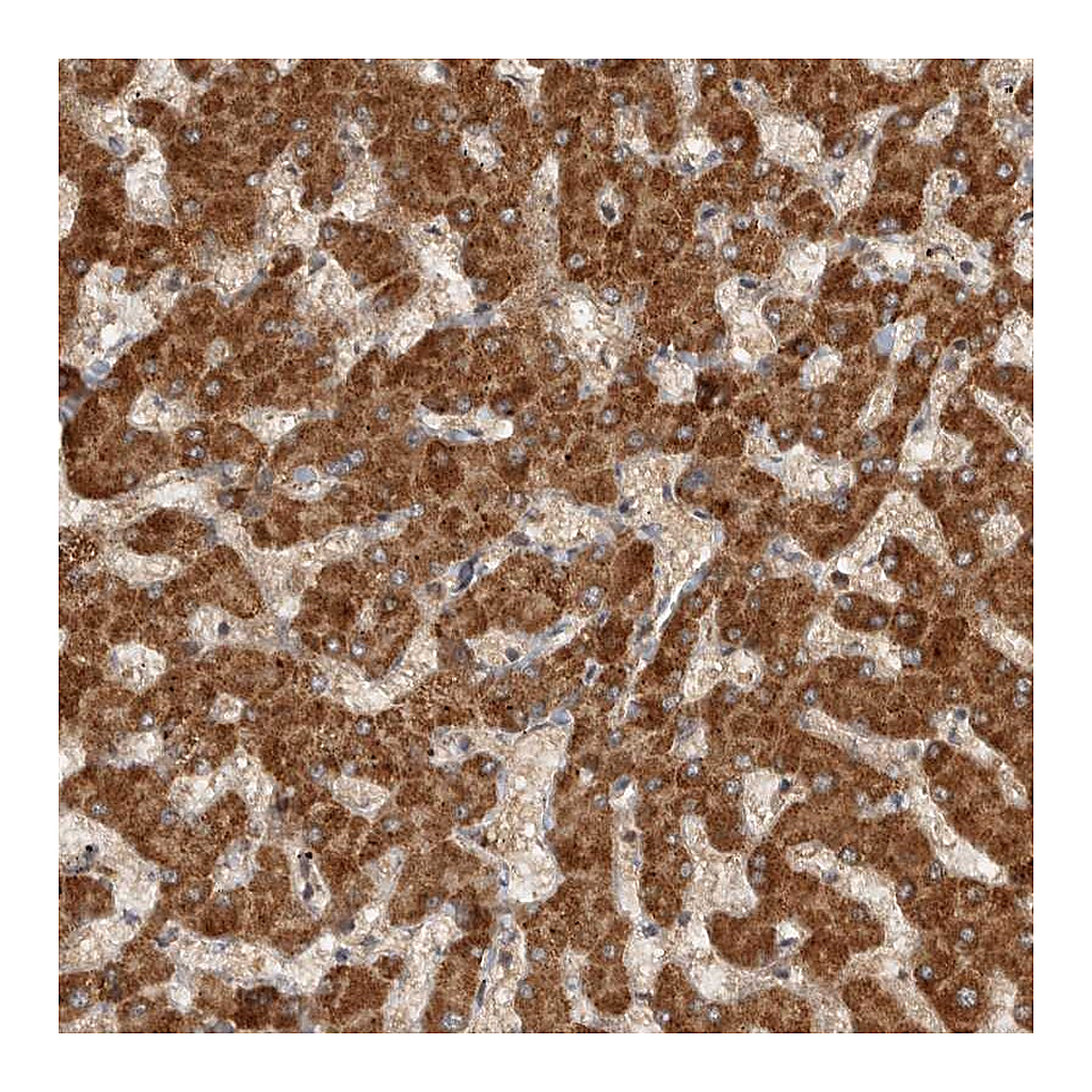 Atlas Antibodies Anti-SWT1 Antibody