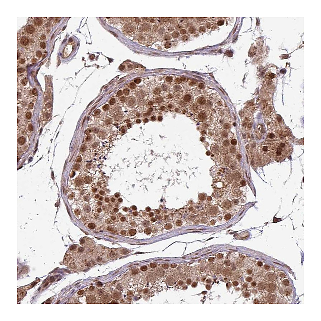 Atlas Antibodies Anti-SWI5 Antibody